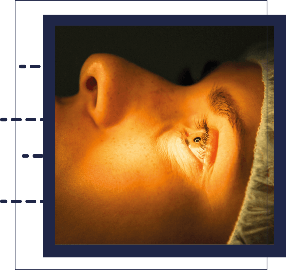 Cirugía Femto-LASIK con tecnología láser